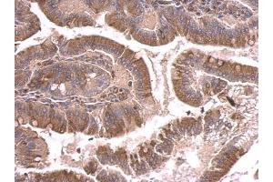 IHC-P Image beta Tubulin 2 antibody detects beta Tubulin 2 protein at cytosol on mouse duodenum by immunohistochemical analysis. (TUBB2A anticorps)