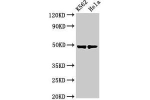 Western Blot Positive WB detected in: K562 whole cell lysate, Hela whole cell lysate All lanes: KRT18 antibody at 3 μg/mL Secondary Goat polyclonal to rabbit IgG at 1/50000 dilution Predicted band size: 49 kDa Observed band size: 49 kDa