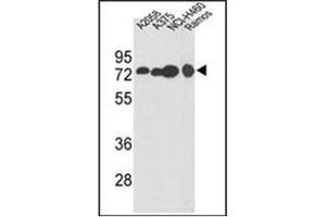 Western blot analysis of HADHA Antibody (C-term) in A2058, A375, NCI-H460, Ramos cell line lysates (35ug/lane).