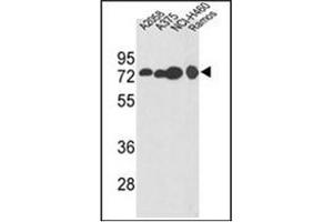 Western blot analysis of HADHA Antibody (C-term) in A2058, A375, NCI-H460, Ramos cell line lysates (35ug/lane). (HADHA anticorps  (C-Term))