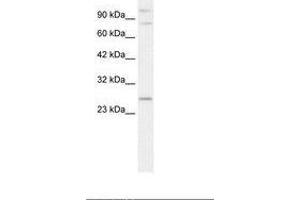 Image no. 1 for anti-Polycomb Group Ring Finger 3 (PCGF3) (AA 103-152) antibody (ABIN202112) (PCGF3 anticorps  (AA 103-152))