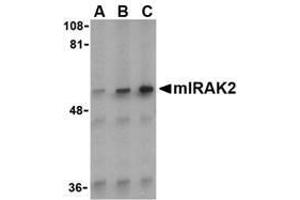 Western blot analysis of IRAK2 in A-20 whole cell lysate with AP30440PU-N IRAK2 antibody (C2) at (A) 0. (IRAK2 anticorps  (C-Term))