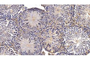 Detection of IDE in Mouse Testis Tissue using Polyclonal Antibody to Insulin Degrading Enzyme (IDE)