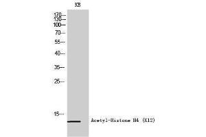 Western Blotting (WB) image for anti-Histone H4 (acLys12) antibody (ABIN3181872) (Histone H4 anticorps  (acLys12))