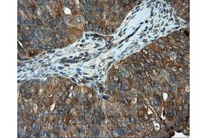 Immunohistochemical staining of paraffin-embedded Kidney tissue using anti-RC201933 mouse monoclonal antibody. (PIM2 anticorps)