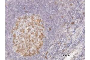 Image no. 1 for anti-Cyclin-Dependent Kinase 1 (CDK1) (AA 211-298) antibody (ABIN598557) (CDK1 anticorps  (AA 211-298))