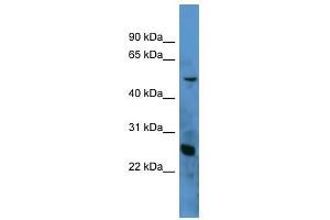 Western Blot showing C1QA antibody used at a concentration of 1-2 ug/ml to detect its target protein. (C1QA anticorps  (N-Term))