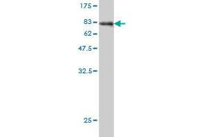 Western Blot detection against Immunogen (78. (AKT1 anticorps  (AA 1-480))