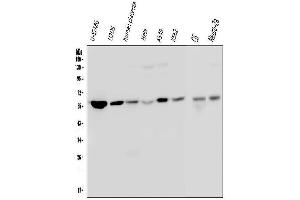 Western blot analysis of Optineurin/OPTN using anti-Optineurin/OPTN antibody (ABIN6719352).