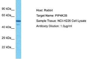 Host: Rabbit Target Name: PIP4K2B Sample Type: NCI-H226 Whole Cell lysates Antibody Dilution: 1.