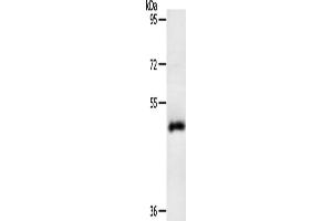 Gel: 10 % SDS-PAGE, Lysate: 40 μg, Lane: Human liver cancer tissue, Primary antibody: ABIN7131158(SPATA17 Antibody) at dilution 1/200, Secondary antibody: Goat anti rabbit IgG at 1/8000 dilution, Exposure time: 10 minutes (SPATA17 anticorps)