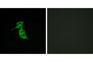 Peptide - +Immunofluorescence analysis of LOVO cells, using GPR143 antibody. (GPR143 anticorps  (Internal Region))
