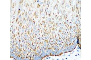 Immunohistochemistry of paraffin-embedded Human esophagus using MTCO2 Polyclonal Antibody at dilution of 1:100 (40x lens). (COX2 anticorps)