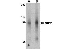 Western blot analysis of FNIP2 in mouse skeletal muscle lysate with AP30346PU-N FNIP2 antibody at (A) 1 and (B) 2 μg/ml. (FNIP2 anticorps  (N-Term))