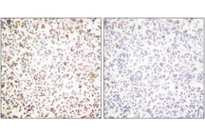 Immunohistochemistry analysis of paraffin-embedded human lymph node tissue, using OCT1 Antibody. (POU2F1 anticorps  (AA 41-90))
