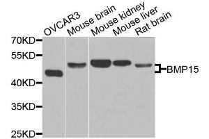 Western blot analysis of extracts of various cells, using BMP15 antibody. (BMP15 anticorps)
