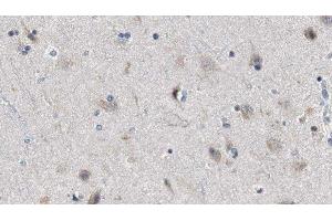 anti-Endophilin-A3 (SH3GL3) (Internal Region) antibody