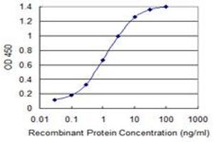 Detection limit for recombinant GST tagged SLC2A10 is 0.