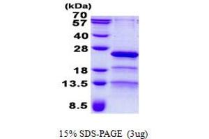 Image no. 1 for Retinitis Pigmentosa 9 (Autosomal Dominant) (RP9) protein (His tag) (ABIN1098481) (RP9 Protein (His tag))