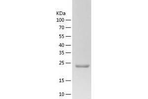 Western Blotting (WB) image for ZW10 Interactor (ZWINT) (AA 1-230) protein (His-IF2DI Tag) (ABIN7125819)