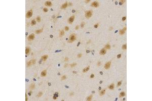 Immunohistochemistry of paraffin-embedded rat brain using ELAVL1 antibody at dilution of 1:200 (x400 lens).