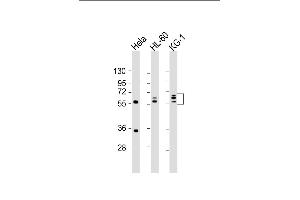 All lanes : Anti-FGL2 Antibody (C-term) at 1:2000 dilution Lane 1: Hela whole cell lysate Lane 2: HL-60 whole cell lysate Lane 3: KG-1 whole cell lysate Lysates/proteins at 20 μg per lane. (FGL2 anticorps  (C-Term))