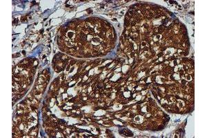 Immunohistochemistry (IHC) image for anti-Proteasome (Prosome, Macropain) Subunit, beta Type, 9 (Large Multifunctional Peptidase 2) (PSMB9) (AA 21-219) antibody (ABIN1491194)