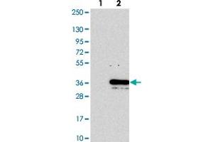 Western blot analysis of Lane 1: Negative control (vector only transfected HEK293T lysate). (PYM anticorps)