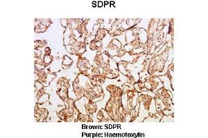 Sample Type :  Human placental tissue   Primary Antibody Dilution :   1:50  Secondary Antibody :  Goat anti rabbit-HRP   Secondary Antibody Dilution :   1:10,000  Color/Signal Descriptions :  Brown: SDPR Purple: Haemotoxylin  Gene Name :  Sdpr  Submitted by :  Dr. (SDPR anticorps  (N-Term))