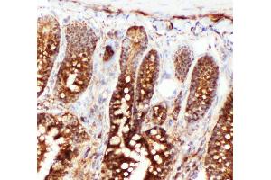Anti-Hsc70 antibody, IHC(F) IHC(F): Rat Intestine Tissue