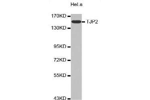 Western Blotting (WB) image for anti-Tight Junction Protein 2 (Zona Occludens 2) (TJP2) (AA 951-1190) antibody (ABIN6213898) (TJP2 anticorps  (AA 951-1190))