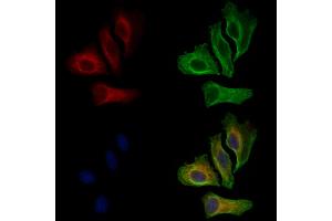ABIN6261462 and ABIN6269075 staining Hela cells by IF/ICC. (EGFR anticorps  (C-Term))