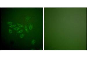 Immunofluorescence analysis of A549 cells, using FHIT antibody (ABIN5976398).