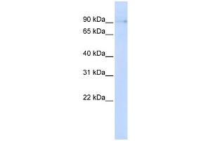 WB Suggested Anti-ZCCHC14 Antibody Titration: 0. (ZCCHC14 anticorps  (N-Term))