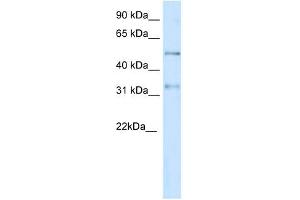 KCNAB2 antibody used at 1 ug/ml to detect target protein. (KCNAB2 anticorps  (Middle Region))