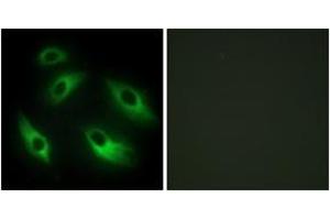 Immunofluorescence analysis of HeLa cells, using EPHB6 Antibody. (EPH Receptor B6 anticorps  (AA 861-910))