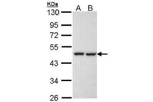 WB Image Sample (30 ug of whole cell lysate) A: H1299 B: Hela 10% SDS PAGE antibody diluted at 1:1000 (KRR1 anticorps)