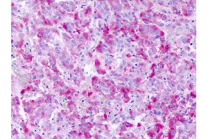 Anti-GPR139 antibody IHC of human adrenal medulla.