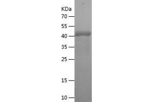 Western Blotting (WB) image for Synovial Sarcoma, X Breakpoint 1 (SSX1) (AA 1-188) protein (His-IF2DI Tag) (ABIN7125286)