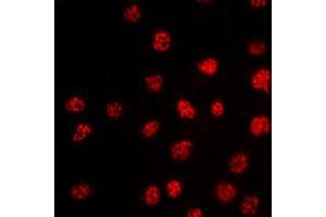Immunofluorescent analysis of TBX15/18 staining in HepG2 cells. (T-Box 15/18 anticorps  (Center))
