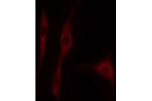 ABIN6274708 staining HepG2 cells by IF/ICC. (ORC1 anticorps  (Internal Region))