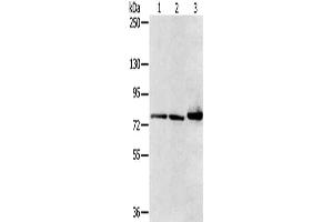 Gel: 6 % SDS-PAGE, Lysate: 40 μg, Lane 1-3: Mouse heart tissue, HT29 cells, mouse liver tissue, Primary antibody: ABIN7128752(CAPN7 Antibody) at dilution 1/300, Secondary antibody: Goat anti rabbit IgG at 1/8000 dilution, Exposure time: 1 second (Calpain 7 anticorps)