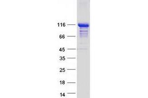 Validation with Western Blot