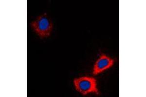 Immunofluorescent analysis of ABCB10 staining in HeLa cells. (ABCB10 anticorps  (Center))