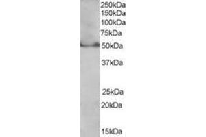 Image no. 1 for anti-Peroxisome Proliferator-Activated Receptor delta (PPARD) (C-Term), (Isoform 1) antibody (ABIN374465) (PPARD anticorps  (C-Term, Isoform 1))