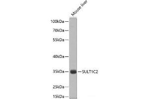 Western blot analysis of extracts of Mouse liver using SULT1C2 Polyclonal Antibody at dilution of 1:1000. (SULT1C2 anticorps)