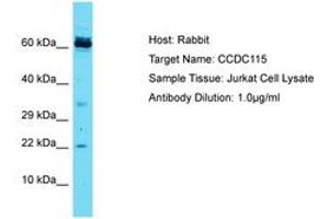 Image no. 1 for anti-Coiled-Coil Domain Containing 115 (CCDC115) (AA 47-96) antibody (ABIN6750443)