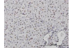Immunoperoxidase of monoclonal antibody to CSTB on formalin-fixed paraffin-embedded human liver.