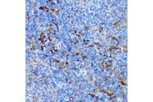 Immunohistochemistry of paraffin-embedded Mouse spleen using P antibody (ABIN7269207) at dilution of 1:100 (40x lens).