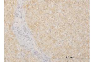 Immunoperoxidase of monoclonal antibody to POMGNT1 on formalin-fixed paraffin-embedded human liver.